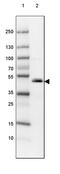 ST6 N-Acetylgalactosaminide Alpha-2,6-Sialyltransferase 2 antibody, PA5-61824, Invitrogen Antibodies, Western Blot image 