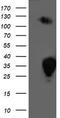 Phosphoglycerate Mutase 2 antibody, TA503399, Origene, Western Blot image 