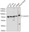 Polypeptide N-acetylgalactosaminyltransferase 3 antibody, GTX66226, GeneTex, Western Blot image 