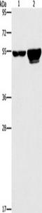 Cell Division Cycle 25A antibody, TA350822, Origene, Western Blot image 