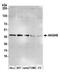 Alpha And Gamma Adaptin Binding Protein antibody, NBP2-59084, Novus Biologicals, Western Blot image 