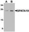 Spermatogenesis Associated 19 antibody, orb75702, Biorbyt, Western Blot image 