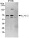 Kelch-like protein 12 antibody, NBP1-49927, Novus Biologicals, Immunoprecipitation image 