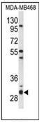 Proteasome Assembly Chaperone 2 antibody, AP53488PU-N, Origene, Western Blot image 