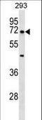 Nuclear Receptor Subfamily 5 Group A Member 2 antibody, LS-C163000, Lifespan Biosciences, Western Blot image 