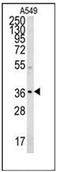 Neugrin, Neurite Outgrowth Associated antibody, AP52872PU-N, Origene, Western Blot image 