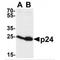 GAG antibody, TA160104, Origene, Western Blot image 
