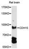 Cadherin 15 antibody, LS-C748822, Lifespan Biosciences, Western Blot image 