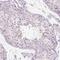 ADAM Metallopeptidase Domain 20 antibody, NBP2-38872, Novus Biologicals, Immunohistochemistry frozen image 