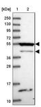 RasGEF Domain Family Member 1B antibody, NBP1-82015, Novus Biologicals, Western Blot image 