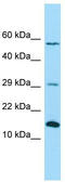 NADH:Ubiquinone Oxidoreductase Subunit B4 antibody, TA333970, Origene, Western Blot image 