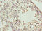 ADAM Metallopeptidase With Thrombospondin Type 1 Motif 12 antibody, A62054-100, Epigentek, Immunohistochemistry paraffin image 