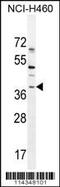 SRY-Box 1 antibody, 56-030, ProSci, Western Blot image 