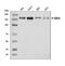 Enhancer Of MRNA Decapping 4 antibody, A05173-2, Boster Biological Technology, Western Blot image 