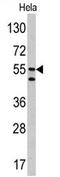 Carbonic Anhydrase 9 antibody, AP17162PU-N, Origene, Western Blot image 