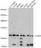 C2 Calcium Dependent Domain Containing 5 antibody, GTX66253, GeneTex, Western Blot image 