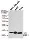 Carbonyl Reductase 1 antibody, M02825, Boster Biological Technology, Western Blot image 