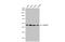 Tumor Susceptibility 101 antibody, GTX118736, GeneTex, Western Blot image 