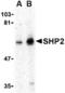 Protein Tyrosine Phosphatase Non-Receptor Type 11 antibody, TA306351, Origene, Western Blot image 
