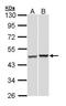 PSMC5 antibody, PA5-28234, Invitrogen Antibodies, Western Blot image 