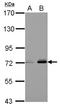 Fermitin family homolog 3 antibody, LS-C155470, Lifespan Biosciences, Western Blot image 