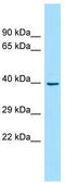 Ankyrin repeat and sterile alpha motif domain-containing protein 1B antibody, TA338283, Origene, Western Blot image 