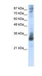 TRNA Methyltransferase 10A antibody, NBP1-80478, Novus Biologicals, Western Blot image 