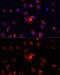 S100 Calcium Binding Protein A4 antibody, GTX32855, GeneTex, Immunocytochemistry image 