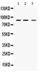 MEFV Innate Immuity Regulator, Pyrin antibody, PA5-79662, Invitrogen Antibodies, Western Blot image 