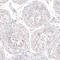 Nanog Homeobox antibody, AMAb91391, Atlas Antibodies, Immunohistochemistry frozen image 