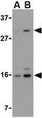 DNA damage-regulated autophagy modulator protein 1 antibody, GTX85484, GeneTex, Western Blot image 