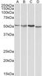 RAC-gamma serine/threonine-protein kinase antibody, TA302640, Origene, Western Blot image 
