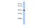 Clavesin 1 antibody, GTX45573, GeneTex, Western Blot image 