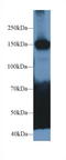 CAPS1 antibody, LS-C702361, Lifespan Biosciences, Western Blot image 
