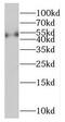 Protein Phosphatase, Mg2+/Mn2+ Dependent 1F antibody, FNab06686, FineTest, Western Blot image 