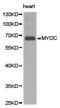 Myocilin antibody, LS-C192844, Lifespan Biosciences, Western Blot image 