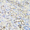 Hydroxysteroid 11-Beta Dehydrogenase 2 antibody, 23-384, ProSci, Immunohistochemistry paraffin image 