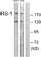 Insulin Receptor Substrate 1 antibody, TA312866, Origene, Western Blot image 