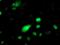 PHD Finger Protein 21B antibody, MA5-25630, Invitrogen Antibodies, Immunocytochemistry image 