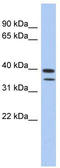 TRNA Methyltransferase 44 Homolog antibody, TA338872, Origene, Western Blot image 
