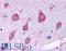Ribosomal Protein L22 antibody, LS-B4941, Lifespan Biosciences, Immunohistochemistry paraffin image 