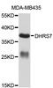 Dehydrogenase/Reductase 7 antibody, abx126885, Abbexa, Western Blot image 