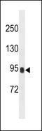 Serine Protease 36 antibody, 60-729, ProSci, Western Blot image 