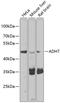 Alcohol Dehydrogenase 7 (Class IV), Mu Or Sigma Polypeptide antibody, 23-242, ProSci, Western Blot image 