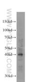 Aurora Kinase B antibody, 60098-1-Ig, Proteintech Group, Western Blot image 