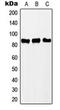 Polyribonucleotide Nucleotidyltransferase 1 antibody, orb224135, Biorbyt, Western Blot image 