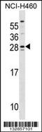 SH3 Domain Binding Glutamate Rich Protein antibody, 58-788, ProSci, Western Blot image 