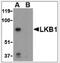 Serine/Threonine Kinase 11 antibody, NBP1-03045, Novus Biologicals, Western Blot image 