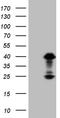 Orthodenticle Homeobox 2 antibody, TA809510, Origene, Western Blot image 
