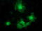 Alcohol Dehydrogenase 1B (Class I), Beta Polypeptide antibody, LS-C172897, Lifespan Biosciences, Immunofluorescence image 